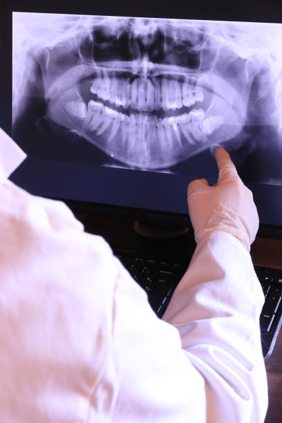 Best After-Hours Emergency Dentist in Upper Lake, CA
