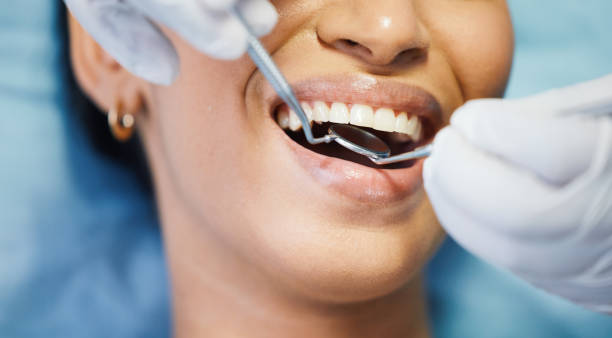 Best Emergency Dental Care for Trauma or Injury in Upper Lake, CA
