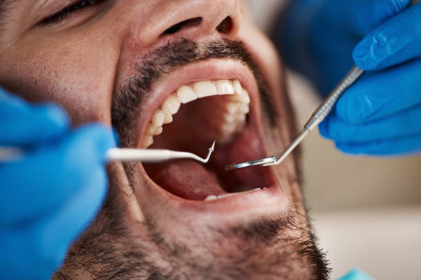 Best Pediatric Emergency Dentist in Upper Lake, CA