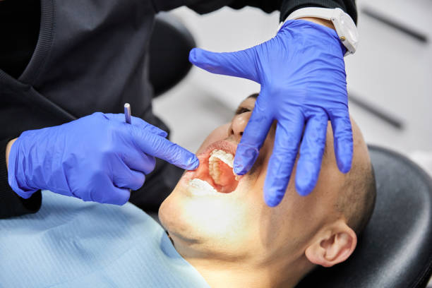 Best Emergency Treatment for Toothache in Upper Lake, CA
